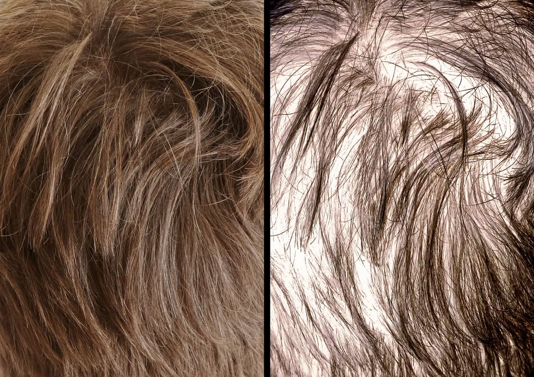 Hair Growth Serum before and after
